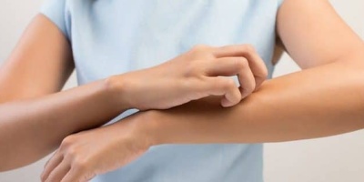 Sebepsiz Kaşıntıya Dikkat !