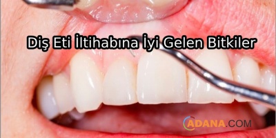 Diş Eti İltihabına Çözüm Olacak 8 Bitki