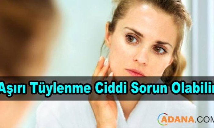 Aşırı Tüylenme Büyük Sorun Olabilir