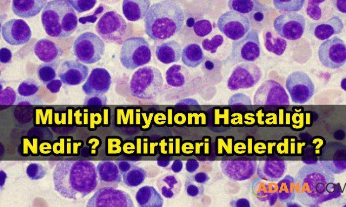 Multipl Miyelom Hastalığı