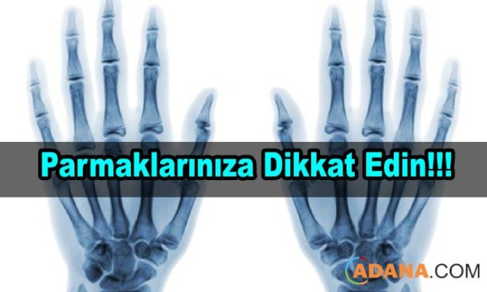 Parmağınızın Kırık Olduğunu nasıl anlarsınız
