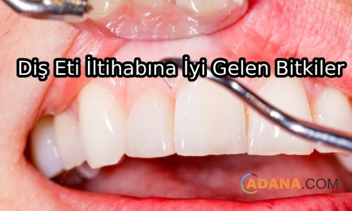 Diş Eti İltihabına Çözüm Olacak 8 Bitki
