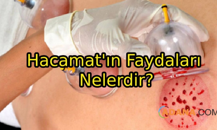 Hacamat'ın Faydaları Nelerdir?