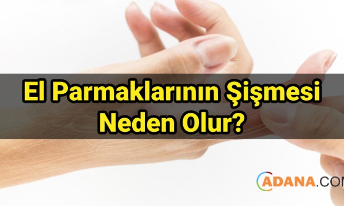 Su Basan Sisen Kabaran Aralari Acan Laminat Parke Tamiri Nasil Yapilir Youtube Laminat Parke Parke Dekorasyon