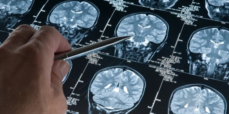 Beyne 25 yıl öncesinden yerleşen hastalık...