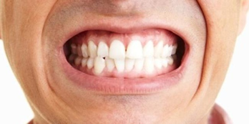 Diş Sıkmanın Zararları