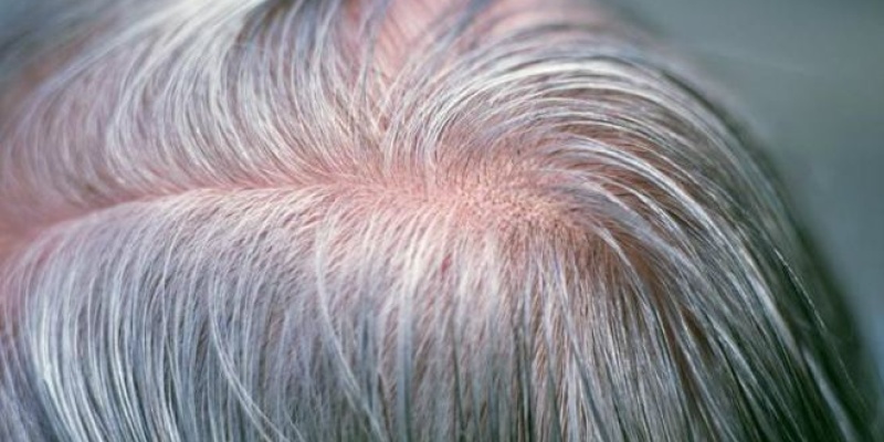 Stres Saçlarınızın Beyazlamasına Neden Olur Mu?