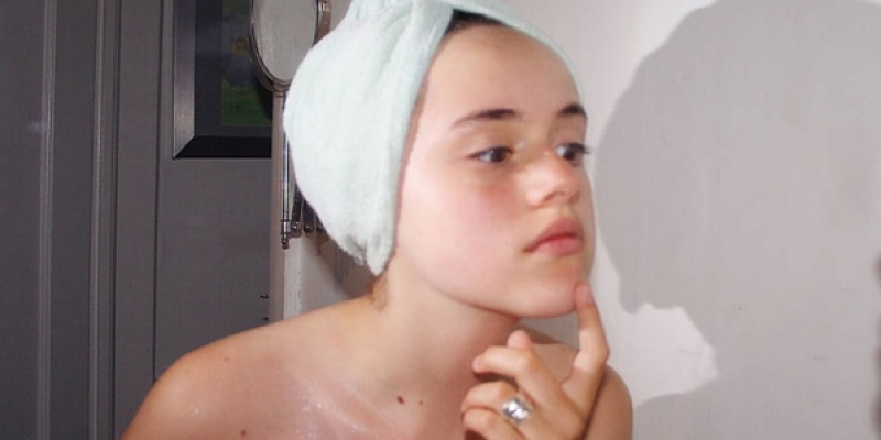 Sivilce Nasıl Geçer?