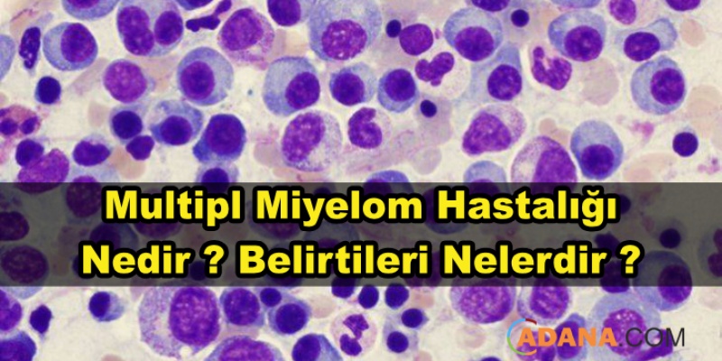 Multipl Miyelom Hastalığı