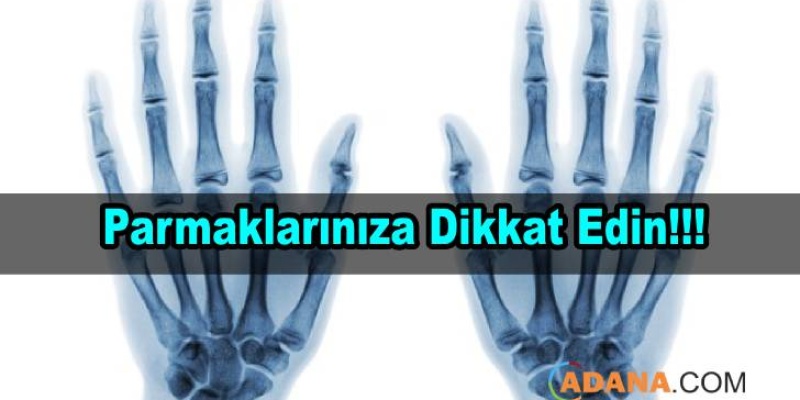 Parmağınızın Kırık Olduğunu nasıl anlarsınız